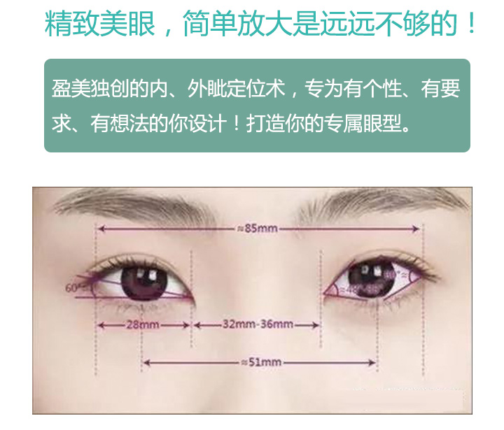 上海眼综合整形 盈美独创 内眦外眦定位 二选一 使眼睛更大更修长